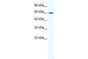 WB Suggested Anti-IRX1 Antibody Titration:  1. (IRX1 anticorps  (N-Term))