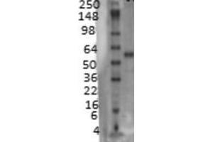 Western blot detection of VACHT on rat membrane tissues using a 1:1000 dilution of SLC18A3 / VACHT Cat. (SLC18A3 anticorps  (AA 521-532))