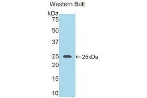 Western Blotting (WB) image for anti-Nexilin (NEXN) (AA 409-605) antibody (ABIN1859994) (NEXN anticorps  (AA 409-605))