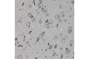 Immunohistochemistry of paraffin-embedded rat brain using UQCRC1 antibody (ABIN1875287) at dilution of 1:100 (40x lens). (UQCRC1 anticorps)