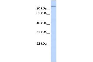 WB Suggested Anti-TXNDC16 Antibody Titration:  0. (TXNDC16 anticorps  (N-Term))