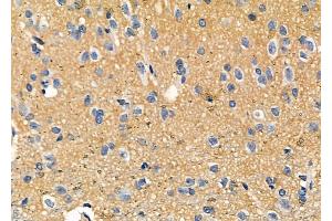 ABIN6257800 and ABIN6273894 at 1/100 staining Rat brain tissue by IHC-P.