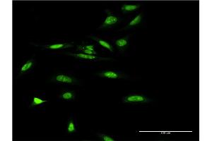 Immunofluorescence of monoclonal antibody to SMARCA5 on HeLa cell.