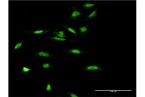 Immunofluorescence of monoclonal antibody to SMARCA5 on HeLa cell. (SMARCA5 anticorps  (AA 59-147))