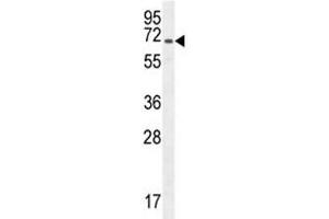 CD31 antibody western blot analysis in CHO lysate.