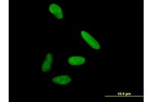 Immunofluorescence of purified MaxPab antibody to KIAA1008 on HeLa cell. (DIS3 anticorps  (AA 1-958))