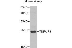 Western blot analysis of extracts of mouse kidney, using TNFAIP8 antibody (ABIN5974482) at 1/1000 dilution. (TNFAIP8 anticorps)