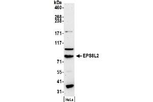 Western Blotting (WB) image for anti-EPS8-Like 2 (EPS8L2) (AA 665-715) antibody (ABIN7450215)
