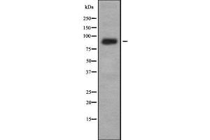 Western blot analysis IL-4R alpha using K562 whole cell lysates
