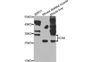 Western blot analysis of extracts of various cell lines, using CA8 antibody (ABIN5975602) at 1/1000 dilution.