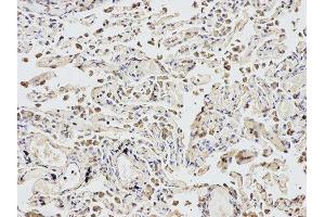Immunohistochemistry (IHC) image for anti-Eukaryotic Translation Initiation Factor 4A2 (EIF4A2) antibody (ABIN1876482) (EIF4A2 anticorps)