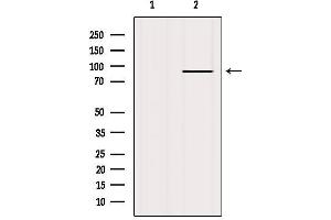 Western blot analysis of extracts from HepG2, using FGFR2 Antibody.