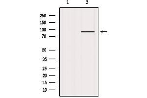 Western blot analysis of extracts from HepG2, using FGFR2 Antibody. (FGFR2 anticorps  (C-Term))