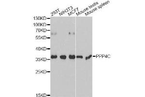 Western blot analysis of extracts of various cell lines, using PPP4C antibody. (PPP4C anticorps  (AA 1-307))