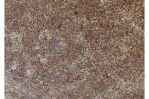 ABIN6257013 and ABIN6274965 at 1/100 staining Mouse spleen tissue by IHC-P. (CBR3 anticorps  (C-Term))