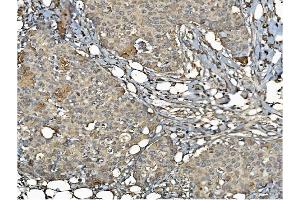 IHC analysis of PDIA6 using anti-PDIA6 antibody (ABIN7600553). (PDIA6 anticorps  (AA 20-440))