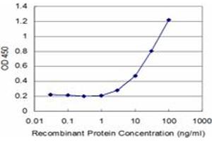 anti-Scaffold Attachment Factor B2 (SAFB2) (AA 103-199) antibody