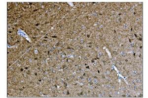IHC analysis of CAMKIV/Camk4 using anti-CAMKIV/Camk4 antibody (ABIN7600419). (CAMK4 anticorps  (AA 19-469))