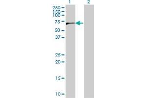 Western Blot analysis of CPSF6 expression in transfected 293T cell line by CPSF6 monoclonal antibody (M10), clone 3F11.