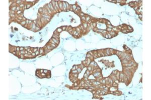 Formalin-fixed, paraffin-embedded human Colon stained with Cytokeratin 19 Rabbit Recombinant Monoclonal Antibody (KRT19/1959R). (Recombinant Cytokeratin 19 anticorps)
