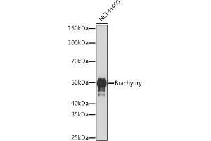 Western blot analysis of extracts of NCI-H460 cells, using Brachyury Rabbit mAb (ABIN1682626, ABIN3019362, ABIN3019363 and ABIN7101757) at 1:1000 dilution. (Scinderin anticorps)