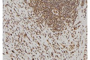 ABIN6275851 at 1/100 staining Human gastric tissue by IHC-P. (PAK7 anticorps  (Internal Region))