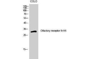 Western Blotting (WB) image for anti-Olfactory Receptor, Family 5, Subfamily H, Member 15 (OR5H15) (C-Term) antibody (ABIN3176614) (OR5H15 anticorps  (C-Term))