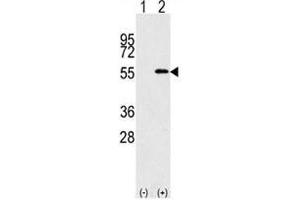 Western blot analysis of NUP50 antibody and 293 cell lysate (2 ug/lane) either nontransfected (Lane 1) or transiently transfected with the NUP50 gene (2). (NUP50 anticorps  (AA 432-461))