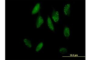 Immunofluorescence of purified MaxPab antibody to SH2B on HeLa cell.