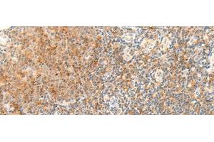 Immunohistochemistry of paraffin-embedded Human tonsil tissue using RAPGEF1 Polyclonal Antibody at dilution of 1:45(x200) (GRF2 anticorps)