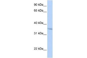 FHL3 antibody used at 0. (FHL3 anticorps  (Middle Region))