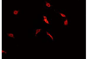 ABIN6269031 staining CACO-2 cells by IF/ICC. (PDGFRA anticorps  (C-Term))
