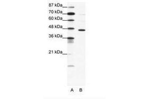 Image no. 1 for anti-gamma-aminobutyric Acid (GABA) A Receptor, pi (GABRP) (AA 28-77) antibody (ABIN202529) (GABRP anticorps  (AA 28-77))