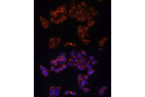 Immunofluorescence analysis of HeLa cells using FKBP5 antibody.
