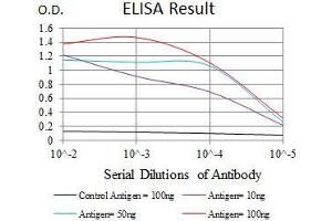 Black line: Control Antigen (100 ng), Purple line: Antigen(10 ng), Blue line: Antigen (50 ng), Red line: Antigen (100 ng),