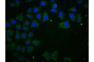 Immunofluorescence staining of Hela cells with ABIN7146194 at 1:100, counter-stained with DAPI. (E-cadherin anticorps  (AA 155-707))
