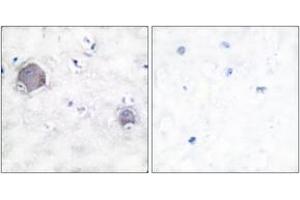Immunohistochemistry analysis of paraffin-embedded human brain tissue, using Notch 1 (Cleaved-Val1754) Antibody.