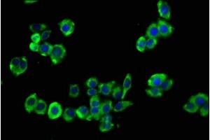 Immunofluorescence staining of PC-3 cells with ABIN7153687 at 1:133, counter-stained with DAPI.