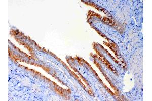IHC analysis of DYNLT1 using anti-DYNLT1 antibody .