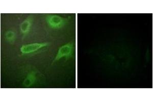Immunofluorescence analysis of HeLa cells, using IL-4R/CD124 (Phospho-Tyr497) Antibody. (IL4 Receptor anticorps  (pTyr497))