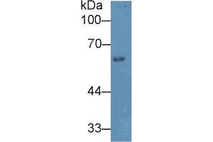 Detection of HPSE in Mouse Skin lysate using Polyclonal Antibody to Heparanase (HPSE) (HPSE anticorps  (AA 353-464))