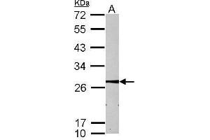 WB Image Sample (30 ug of whole cell lysate) A: HepG2 12% SDS PAGE antibody diluted at 1:1000 (MMAB anticorps  (Center))