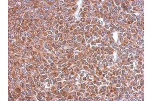 IHC-P Image Immunohistochemical analysis of paraffin-embedded BT483 xenograft, using STIP1, antibody at 1:500 dilution. (STIP1 anticorps)
