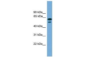 WB Suggested Anti-C19orf45 Antibody Titration: 0. (C19ORF45 anticorps  (Middle Region))