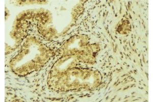 ABIN6277270 at 1/100 staining Mouse colon tissue by IHC-P. (VEGFC anticorps  (Internal Region))