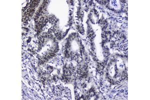 IHC testing of FFPE rat lung tissue with SF1 antibody at 1ug/ml.