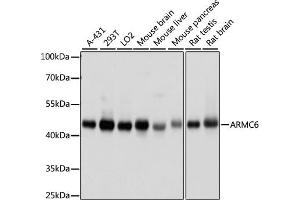 Western blot analysis of extracts of various cell lines, using  antibody (ABIN7265674) at 1000 dilution. (ARMC6 anticorps  (AA 1-220))