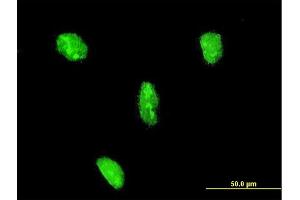 Immunofluorescence of monoclonal antibody to LHX3 on HeLa cell. (LHX3 anticorps  (AA 228-316))
