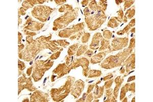 Immunohistochemical analysis of paraffin-embedded human heart section using ROR1 antibody. (ROR1 anticorps)