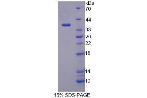 SDS-PAGE analysis of Human PSG2 Protein.